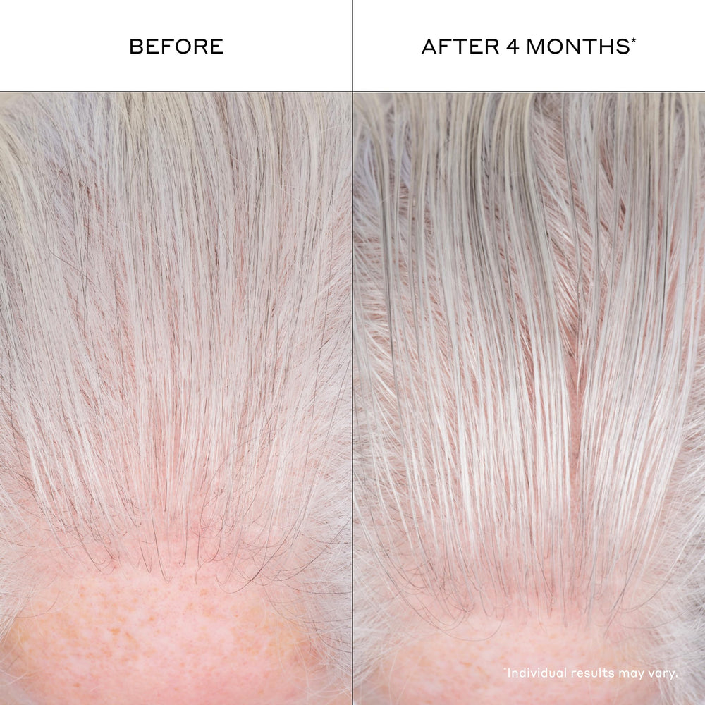 Zenagen pump dispensing a drop of serum indicating controlled dosing and no waste