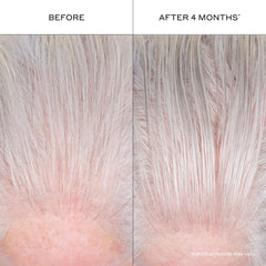 Zenagen pump dispensing a drop of serum indicating controlled dosing and no waste