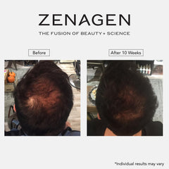 Zenagen Revolve styled on bathroom shelf suggesting daily grooming ritual