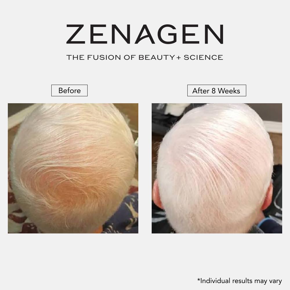 Zenagen Revolve being massaged into scalp to improve texture and lift benefit
