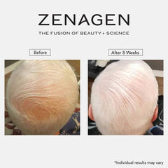 Zenagen Revolve being massaged into scalp to improve texture and lift benefit