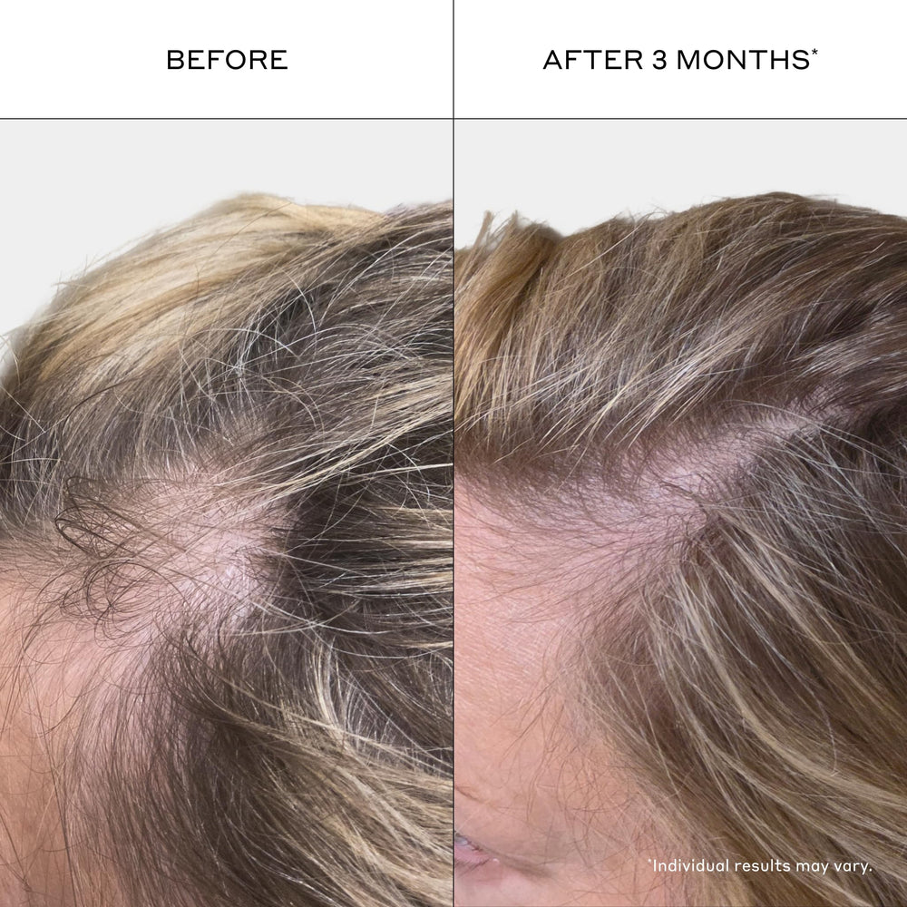 Zenagen shampoo foam texture on palm showing gentle lather and easy spread