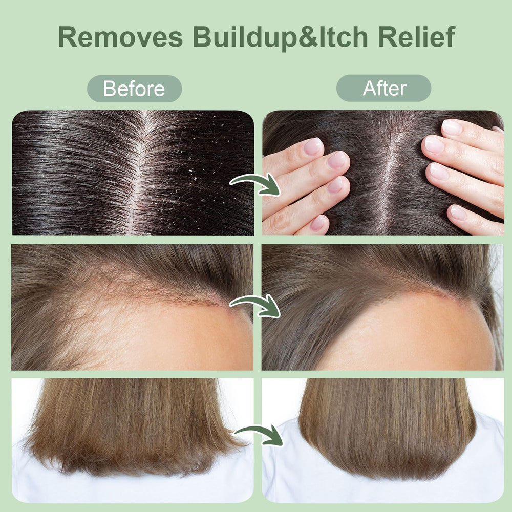 ZENGYQI being massaged into a wet scalp for deeper cleansing