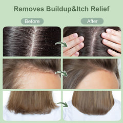 ZENGYQI being massaged into a wet scalp for deeper cleansing