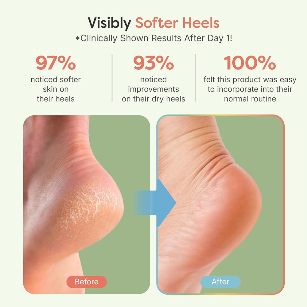 ZenToes on foot showing open-toe design for breathability and comfort
