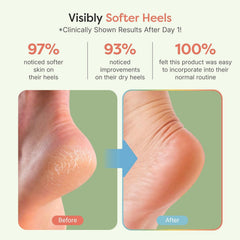 ZenToes on foot showing open-toe design for breathability and comfort
