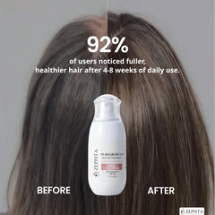 Zephta being applied to a thinning scalp demonstrating easy daily use benefit