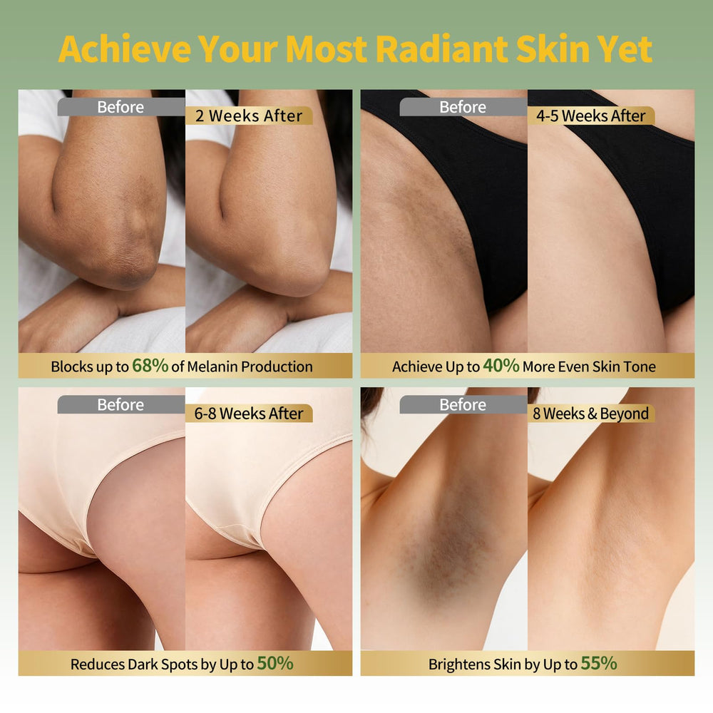 Zestvent applied to bikini line illustrating targeted brightening benefit