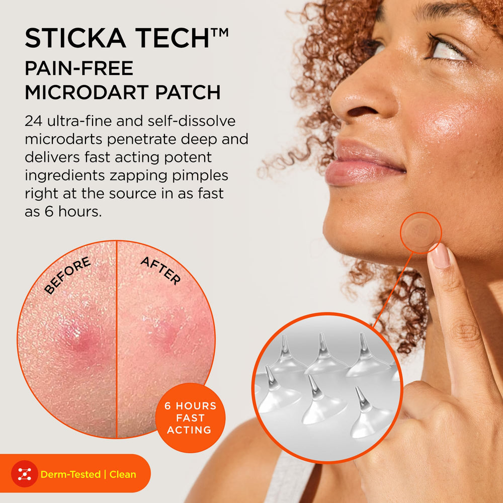 ZitSticka close-up of dissolvable microdarts for targeted delivery