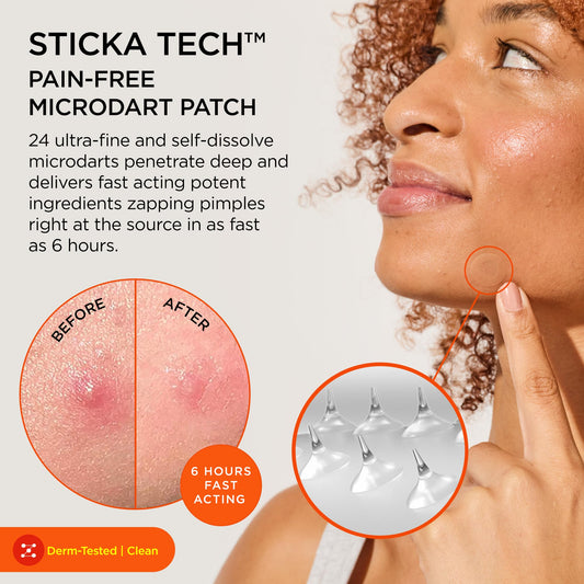 ZitSticka close-up of dissolvable microdarts for targeted delivery