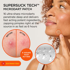 ZitSticka microdart close-up texture highlighting tiny dissolvable darts for direct delivery