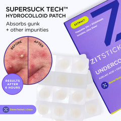ZitSticka patch worn on face demonstrating discreet daytime wear