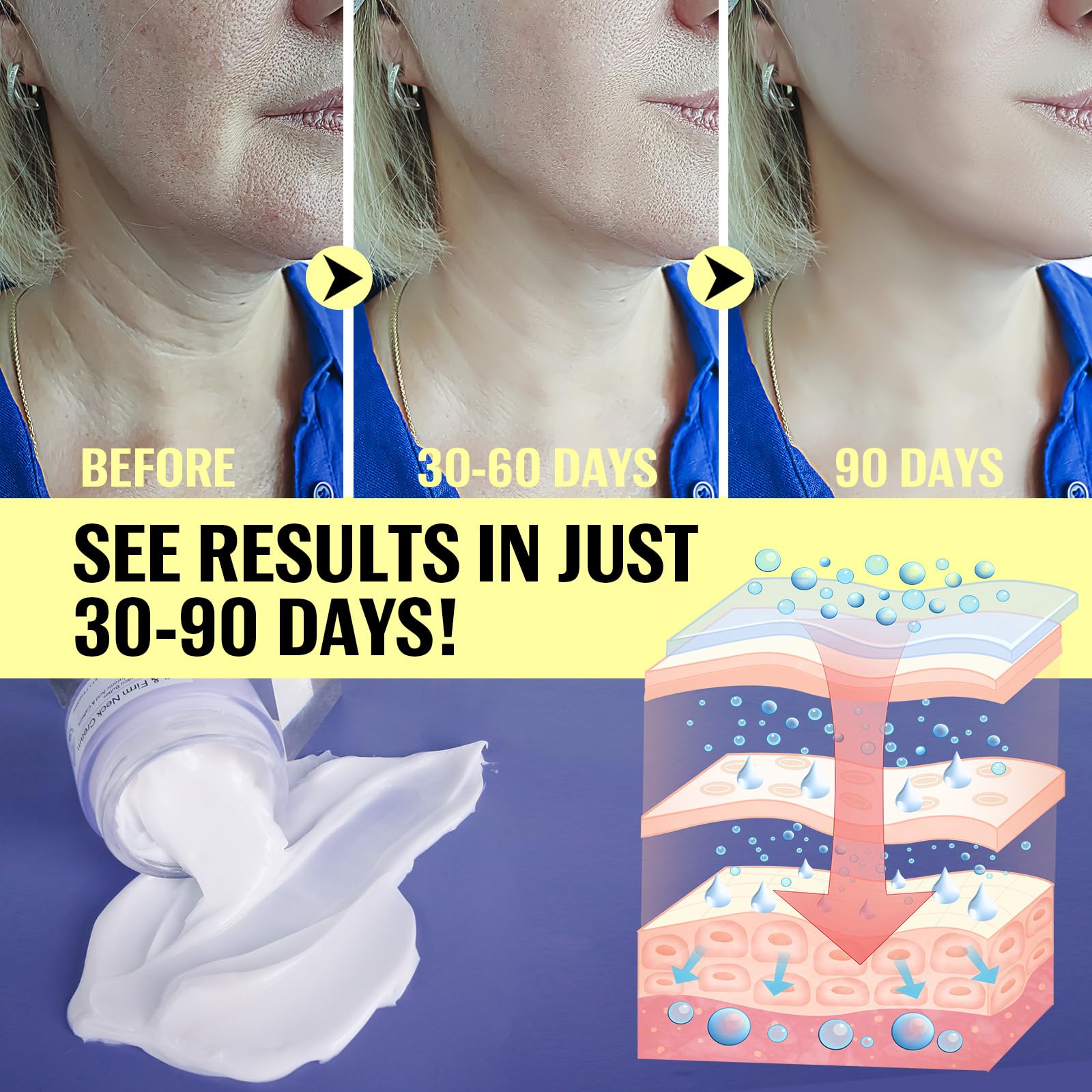 ZIXAOK before after illustration comparison highlighting reduced crepey texture and smoother skin