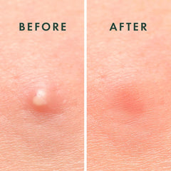ZOVIRA patches on a bathroom counter highlighting nighttime routine convenience
