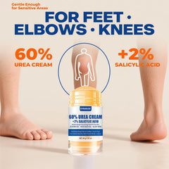 Before and after feet using ZyraGloz showing reduced calluses