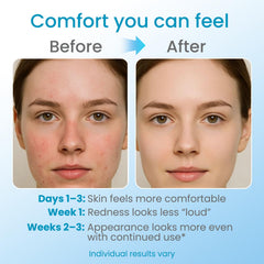 ZZILME applied to hand and wrist to hydrate thin sensitive skin